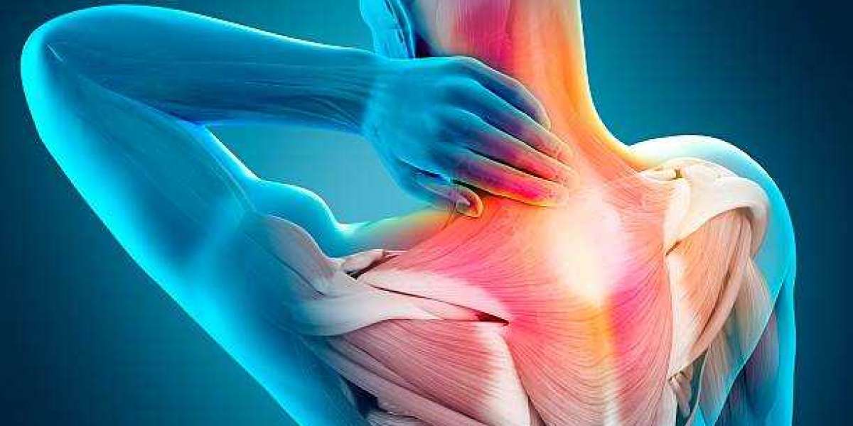 Muscle Pain: Causes, Symptoms, Treatment, Prevention