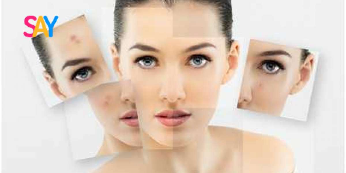 Chemical Peels Texas: The Key to Refreshed and Glowing Skin