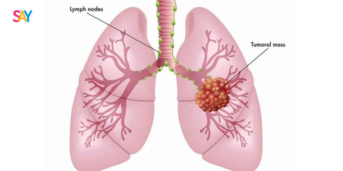 Lung transplant success rate in India