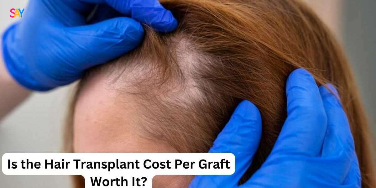 Is the Hair Transplant Cost Per Graft Worth It?