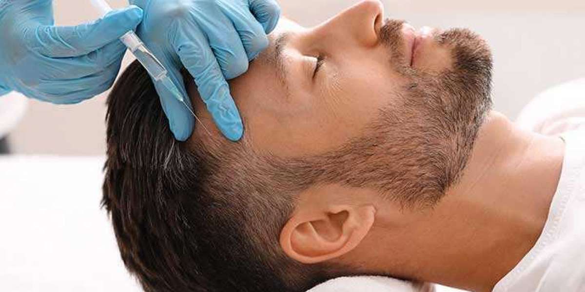 Who Is A Candidate For Hair Transplant?