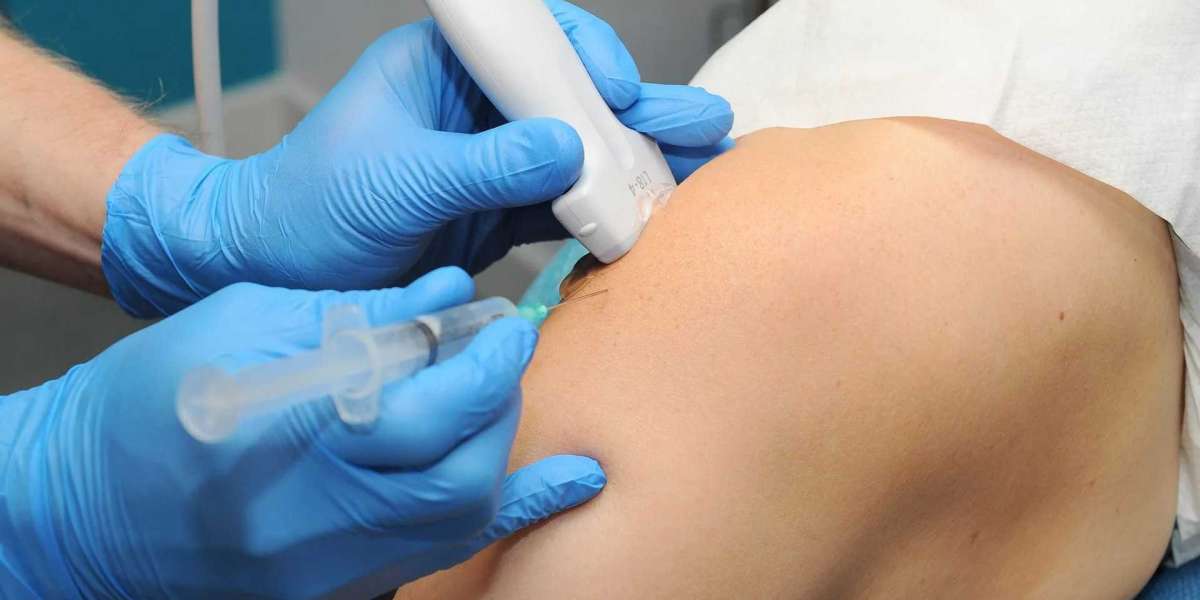 The Comprehensive Guide to Cortisone Injections Cost and Benefits at Sonoscope