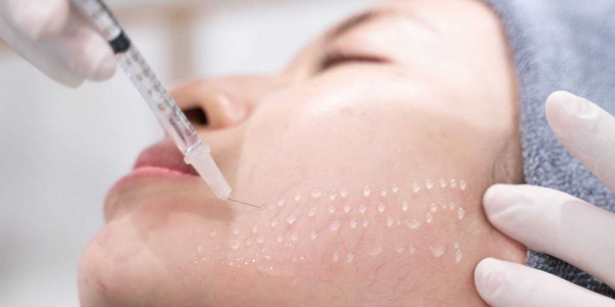 What is the Safety of Mesotherapy?