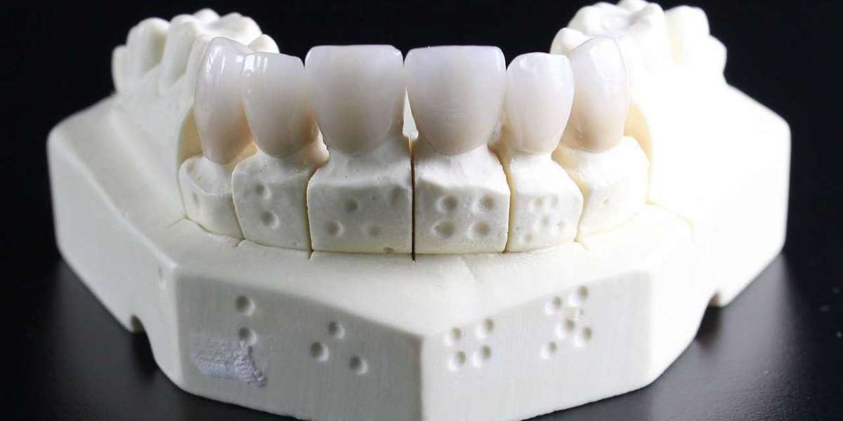 Aftercare for Dental Implants: A Simple Guide to Healing and Maintenance