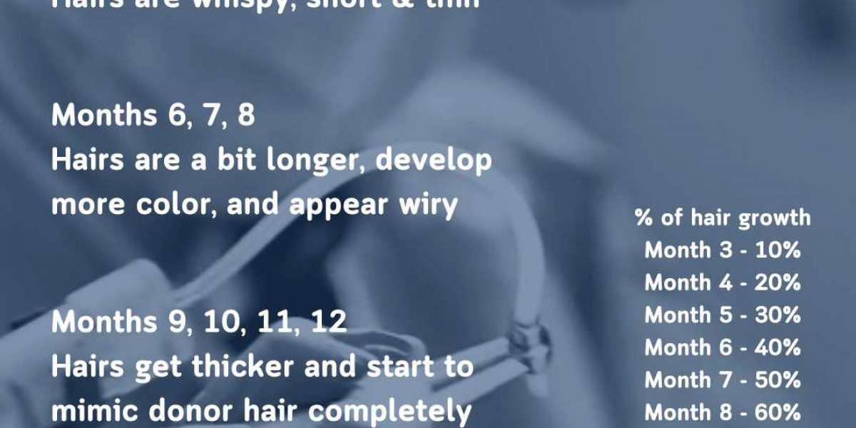 Restore Your Confidence with the Best FUE Hair Transplant in Chicago