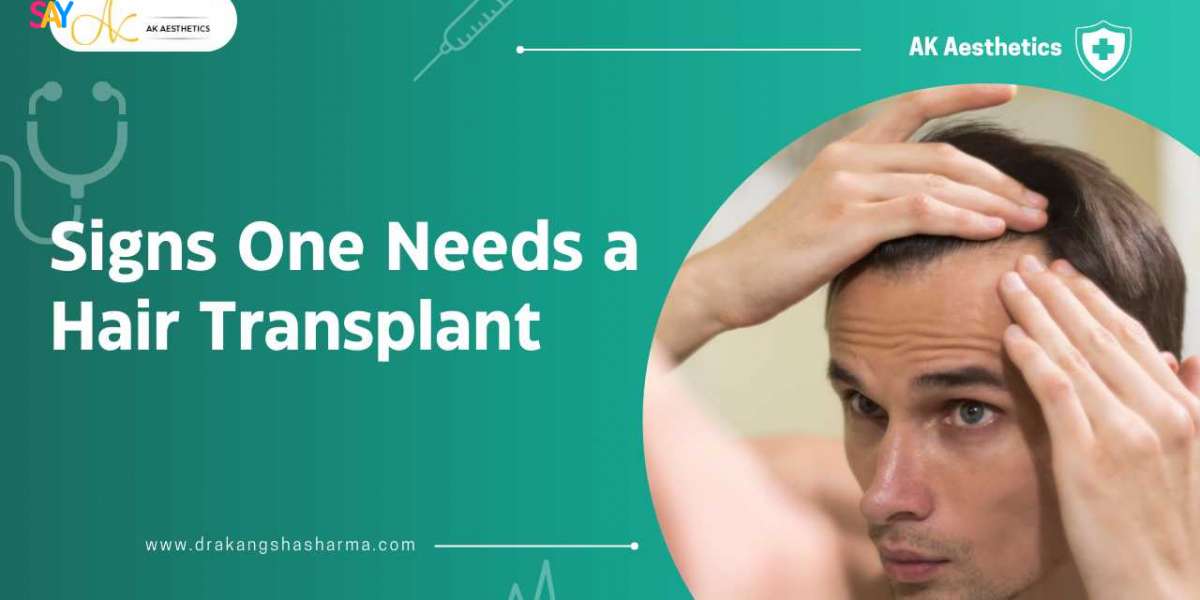 Signs One Need a Hair Transplant
