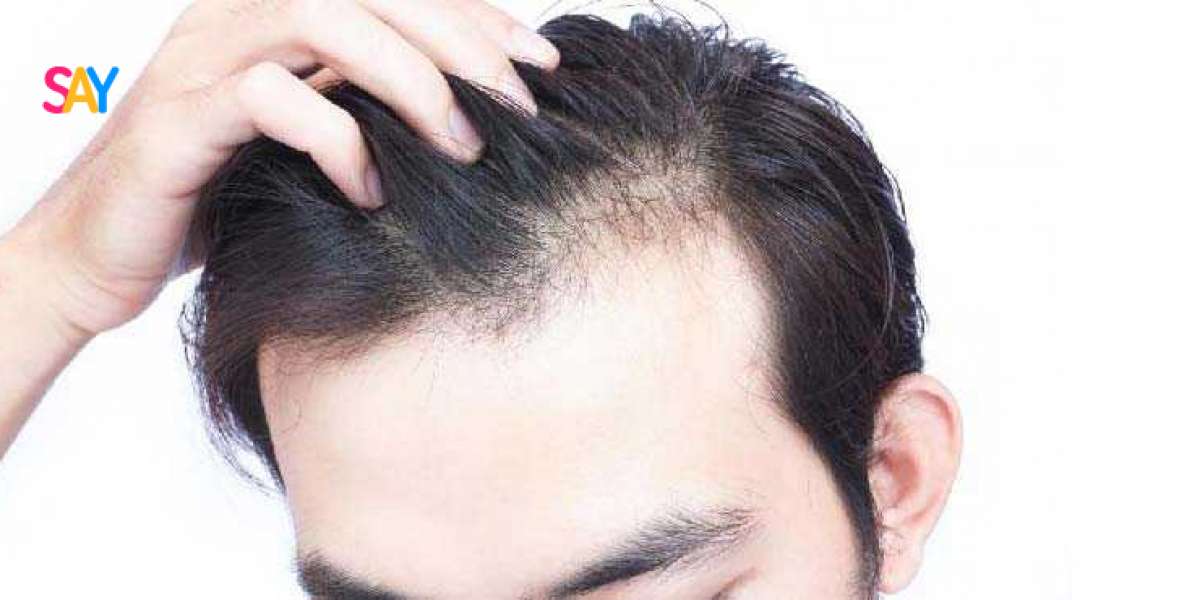 Best Dermatologist In Bangalore For Hair Fall