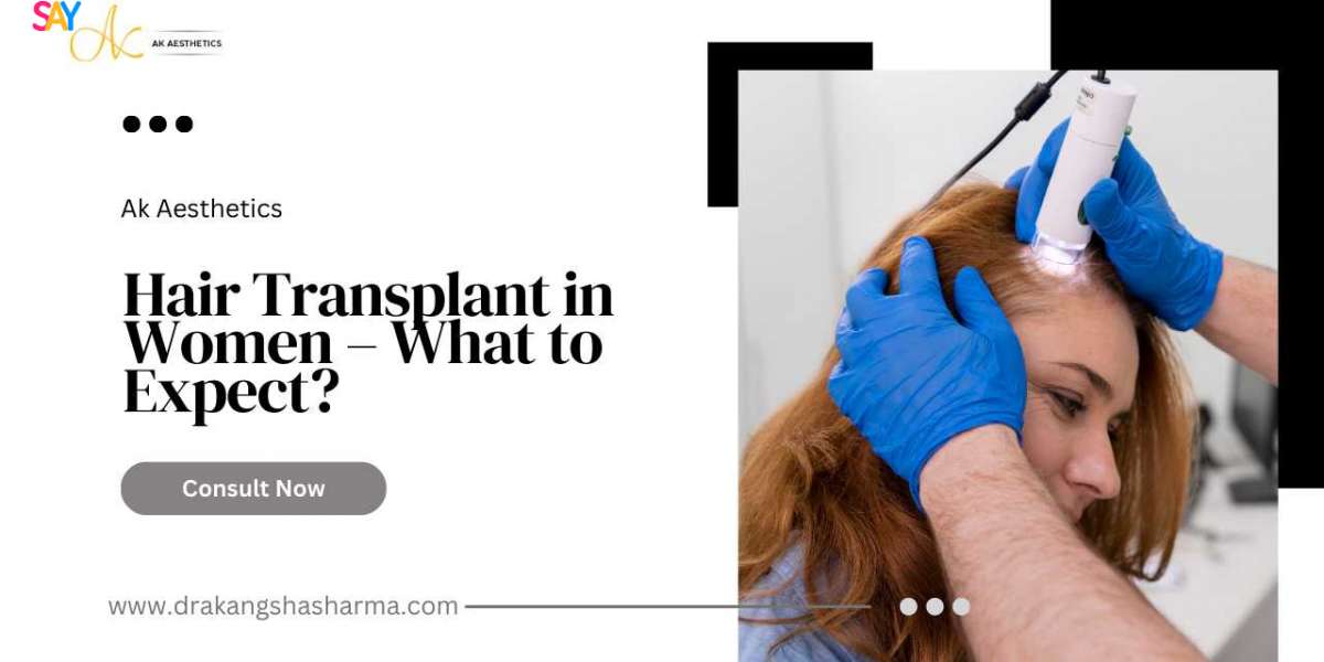 Hair Transplant in Women – What to Expect?