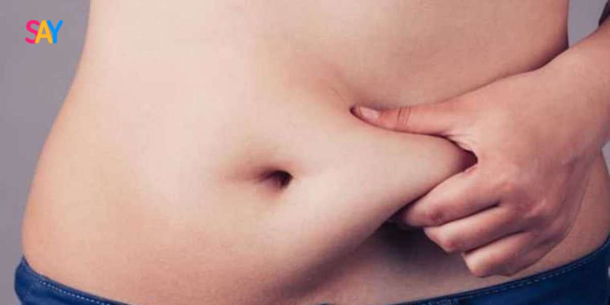 Tummy Tuck: The Key to a Sculpted and Smooth Belly