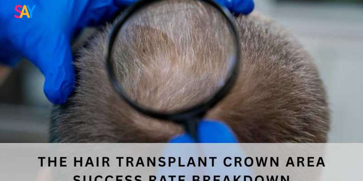 The Hair Transplant Crown Area Success Rate Breakdown