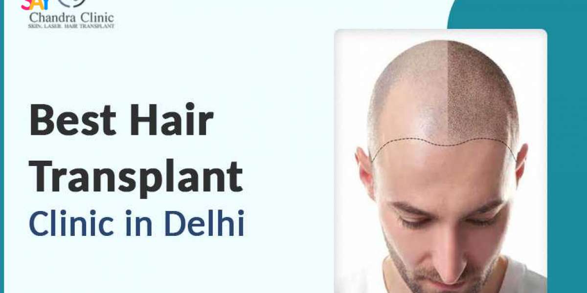 Does FUE Hair Transplant Suit Everyone?