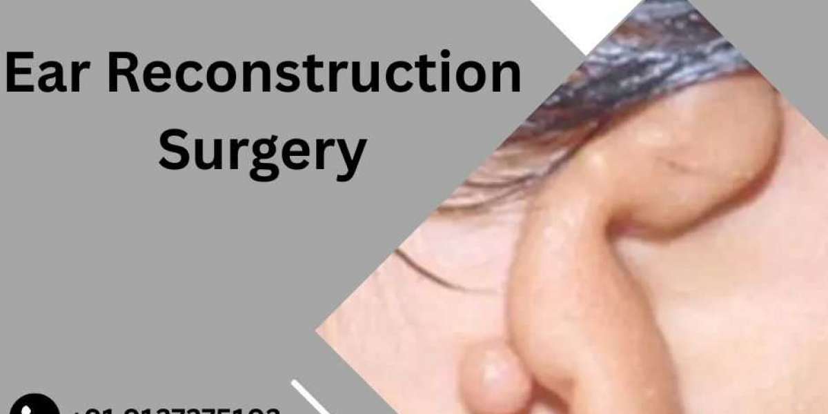 Preparing for Otoplasty: Budgeting For Your Ear Surgery Cost