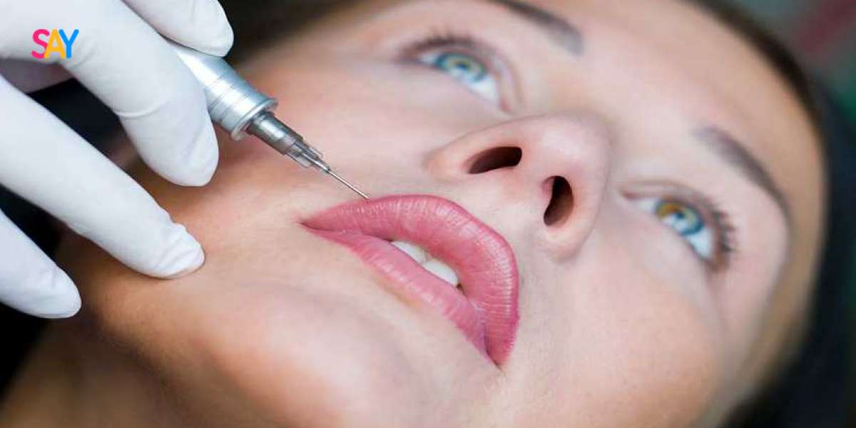 What Are Russian Lip Fillers? Everything You Need to Know