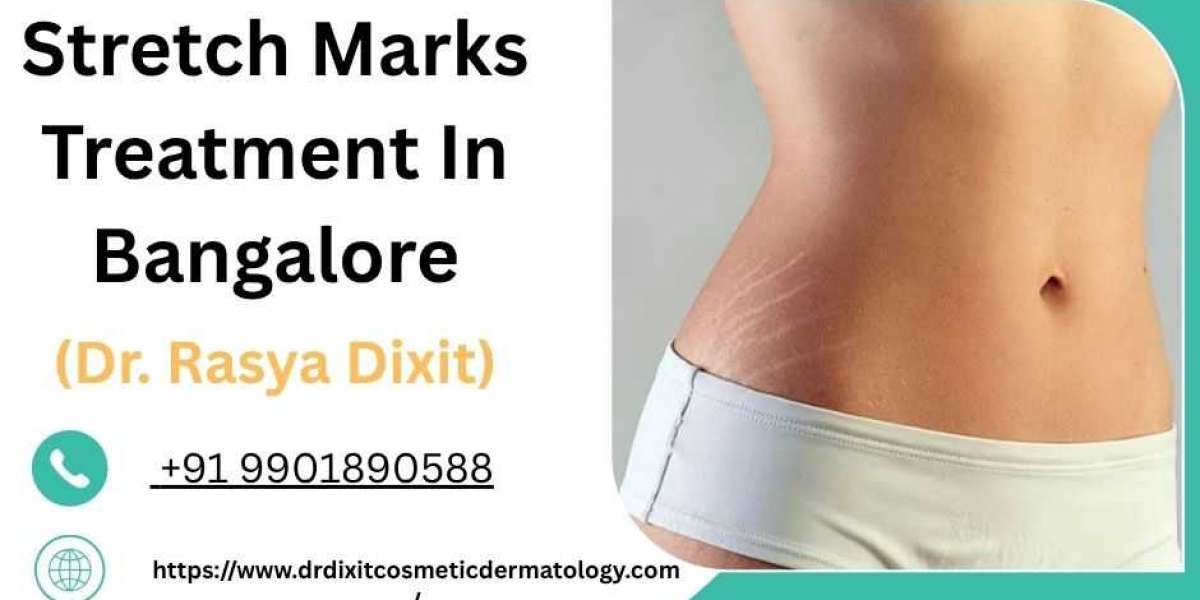 How To Treat Pregnancy Stretch Marks?