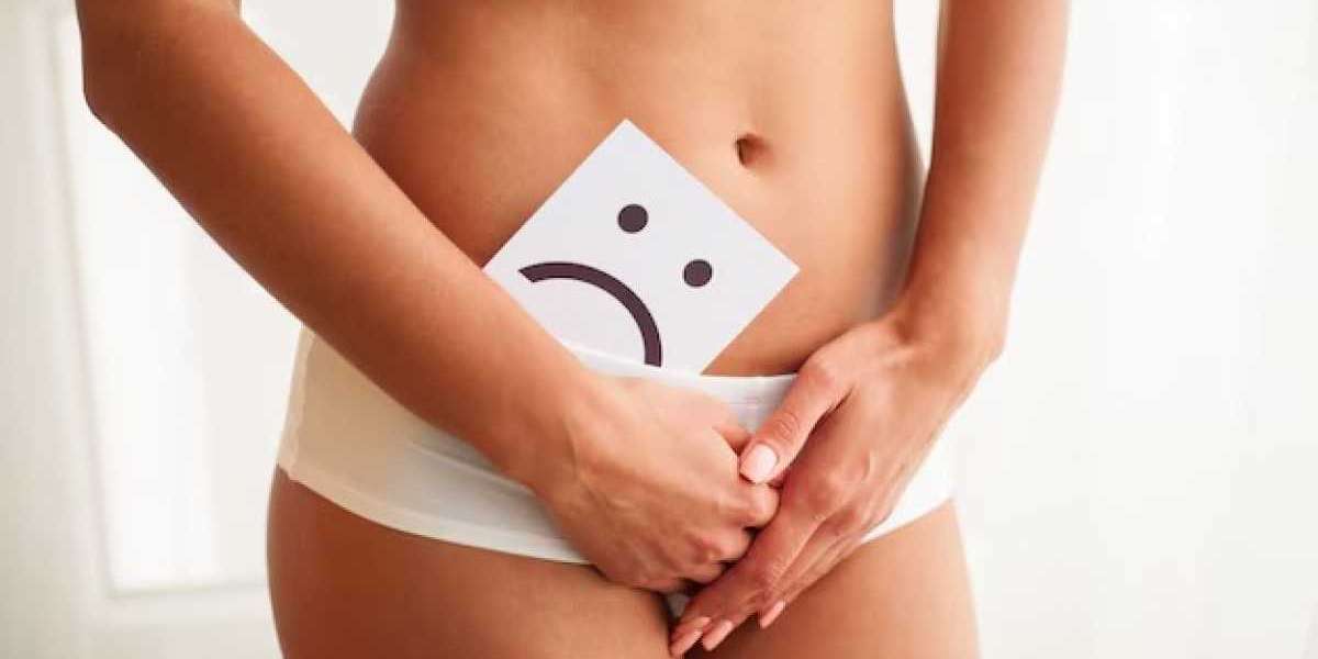 Vaginal Rejuvenation: How Long Do Results Really Last