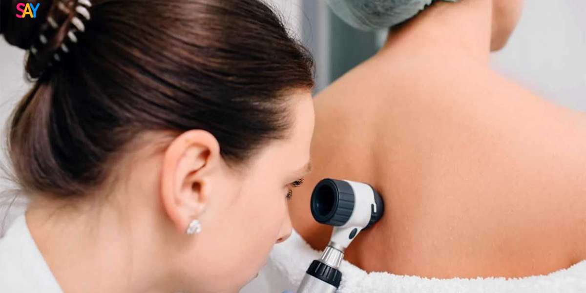 Best Dermatologist Recommendations for Sensitive Scalp Care