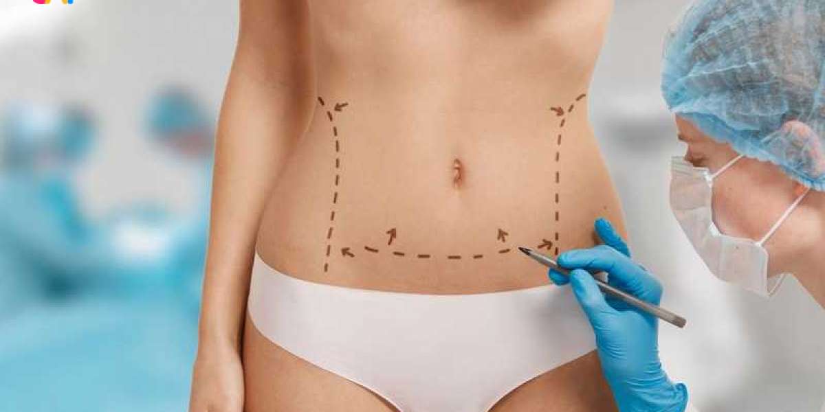 What Is Vaser Liposuction and How Does It Work?