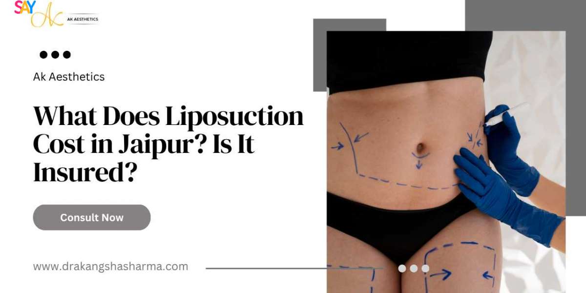 What Does Liposuction Cost in Jaipur? Is It Insured?