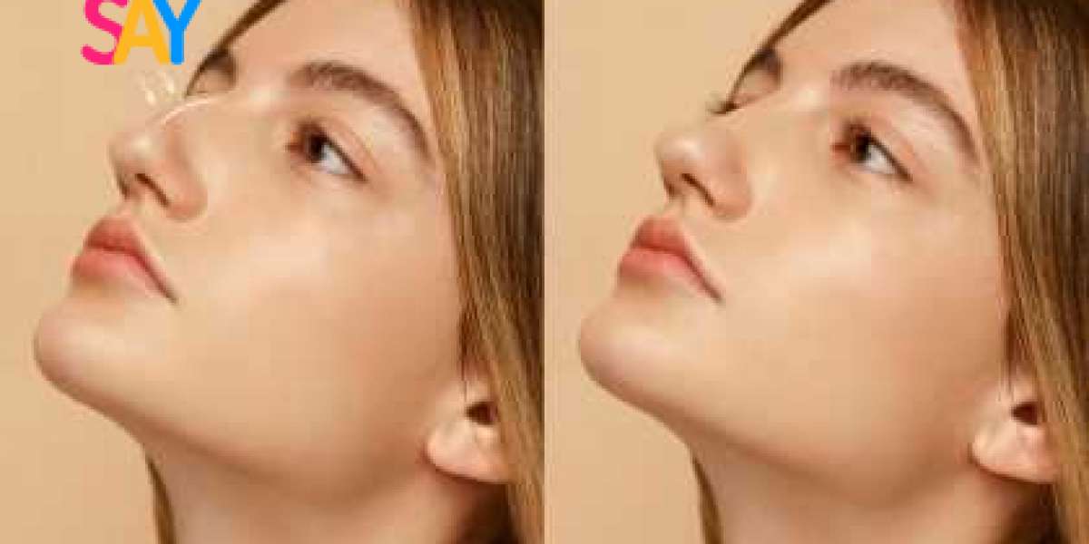 How to Reduce Swelling After Rhinoplasty?