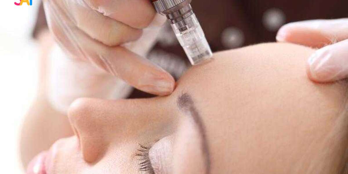 What to Know Before Trying a Vampire Facial for the First Time?