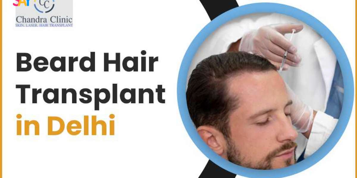 Who is a Good Candidate For Beard Transplants?