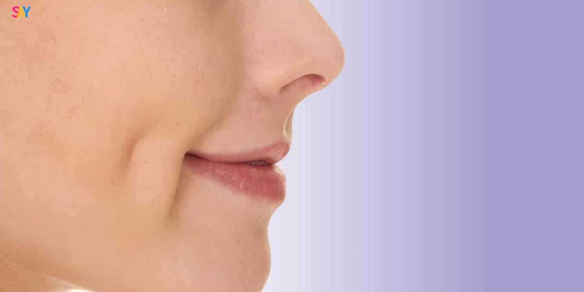 Dimple Creation Surgery: Everything You Need to Know Before Going Under the Knife