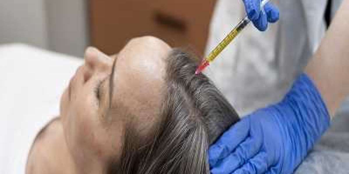 Can PRP regrow hair on a bald scalp?
