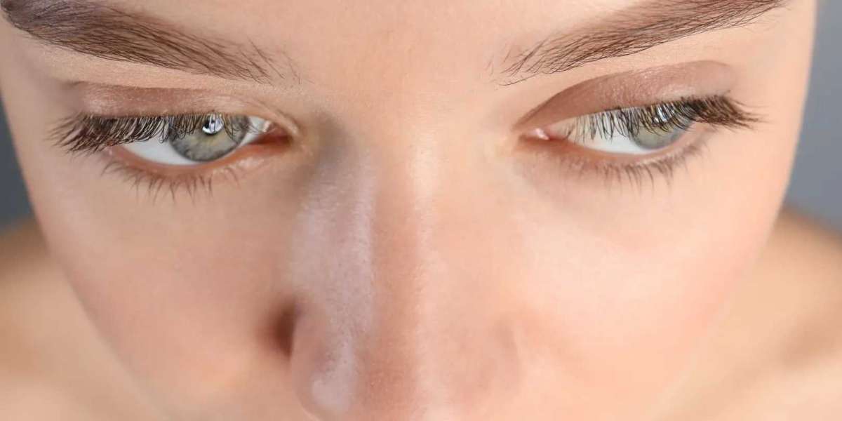 What Is an Eyelash Transplant and How Does It Work?