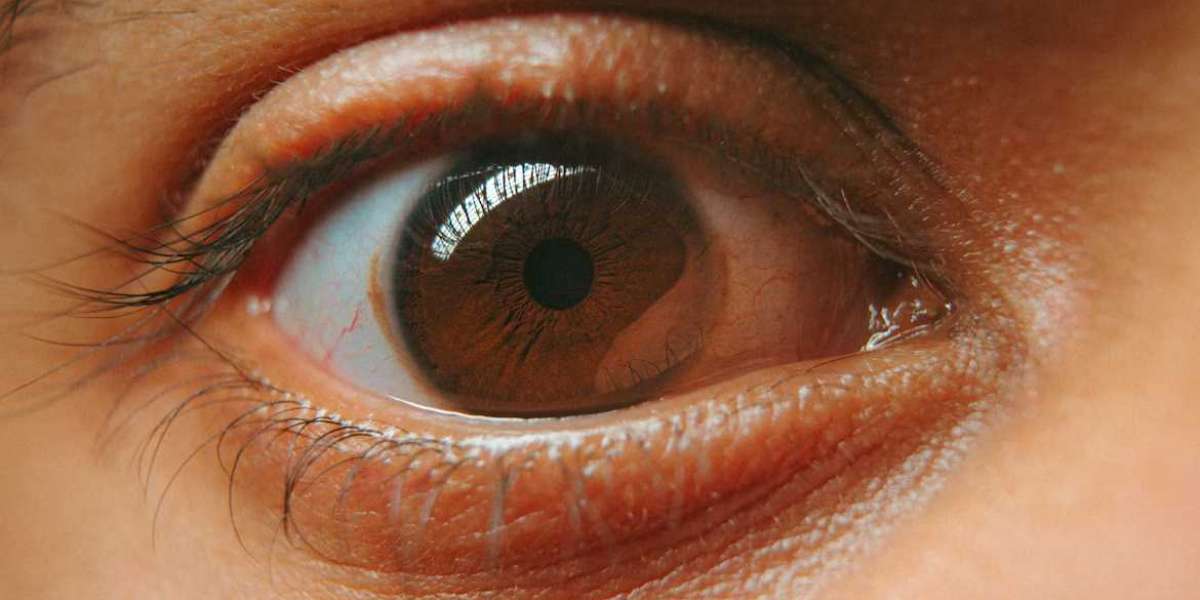 Blue Fin Vision® Laser Eye Surgery London: Tailored Treatments for Your Vision Needs