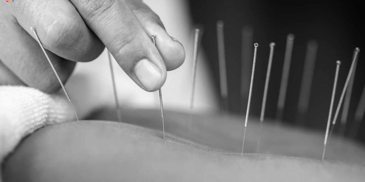 Expert TCM & Acupuncture in Bayside Melbourne